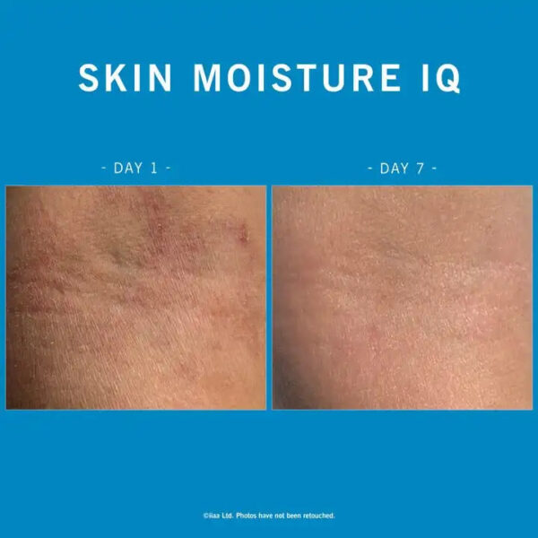 SKIN MOISTURE IQ