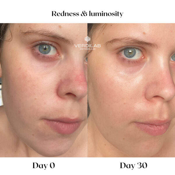 NATURAL MOISTURIZER Probiotic Cream