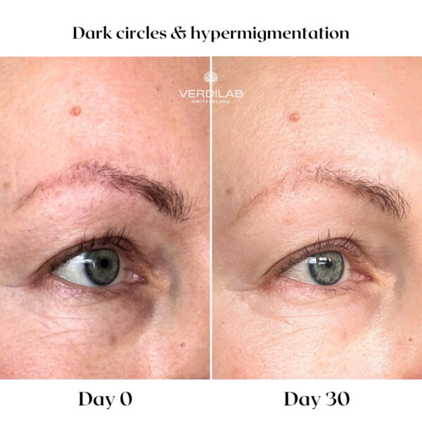 ULTIMATE LIGHTENING Vitamin C Eye Elixir