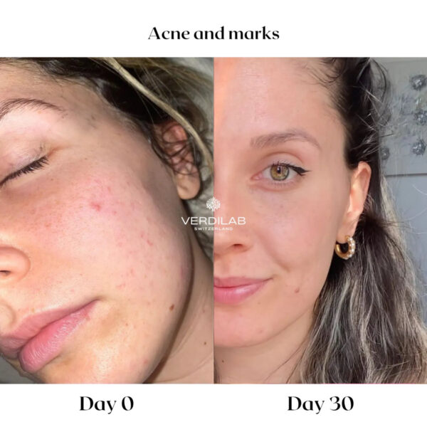 ACID POWER Imperfections Treating Concentrate
